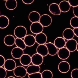 Live Blood Analysis and Gong session